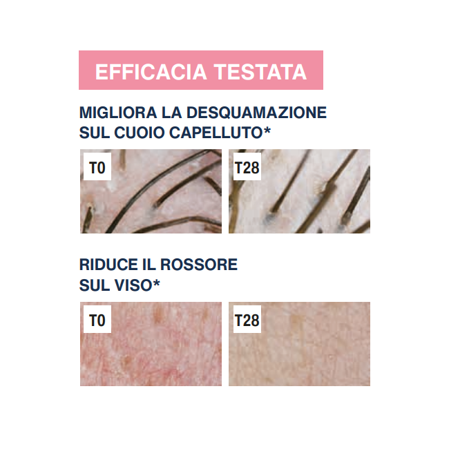 Rilastil Difesa DS Gel Lenitivo anti-squame 30 ml Rilastil Difesa DS Gel Lenitivo anti-squame 30 ml