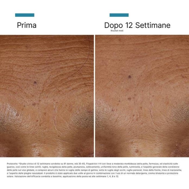 Ha intensifier mod 30 ml