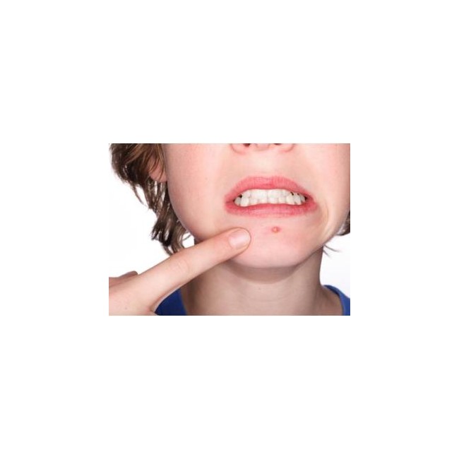 Benzac 10% Gel per acne 40 g