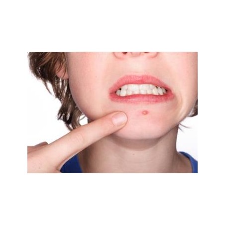 Benzac 10% Gel per acne 40 g