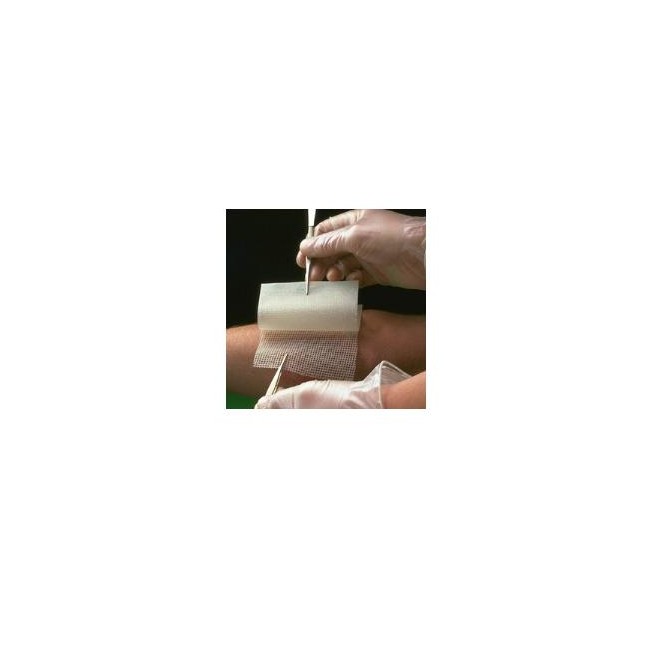 Smith & Nephew Garza Medicata Bactigras Con Clorexidina Acetato 0,5% 15x20cm 10 Pezzi